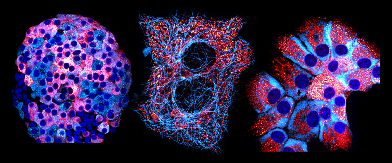 pancreatic beta cells