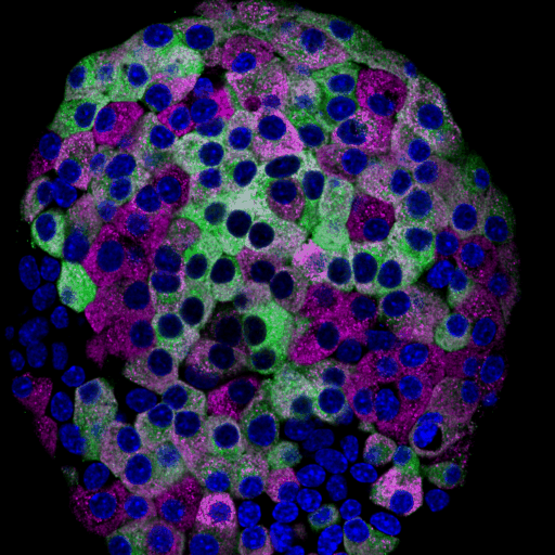 human islet immunostatined for insulin and GAD65